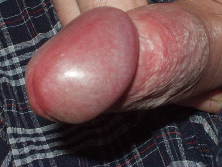 small3