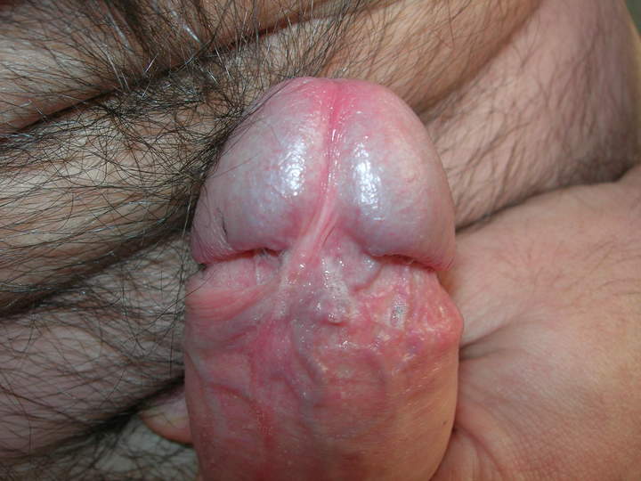 Adult image from winger70