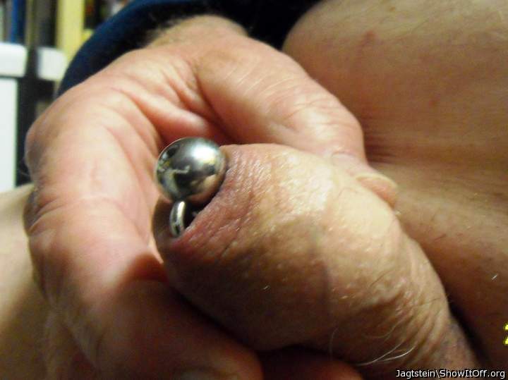 Penis with prince's scepter, foreskin closed