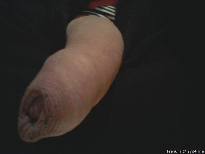 Adult image from Frenum
