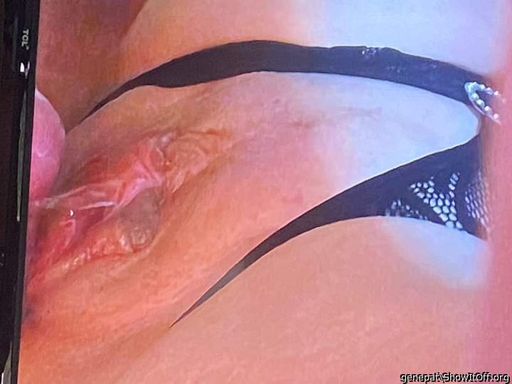 Adult image from genepat