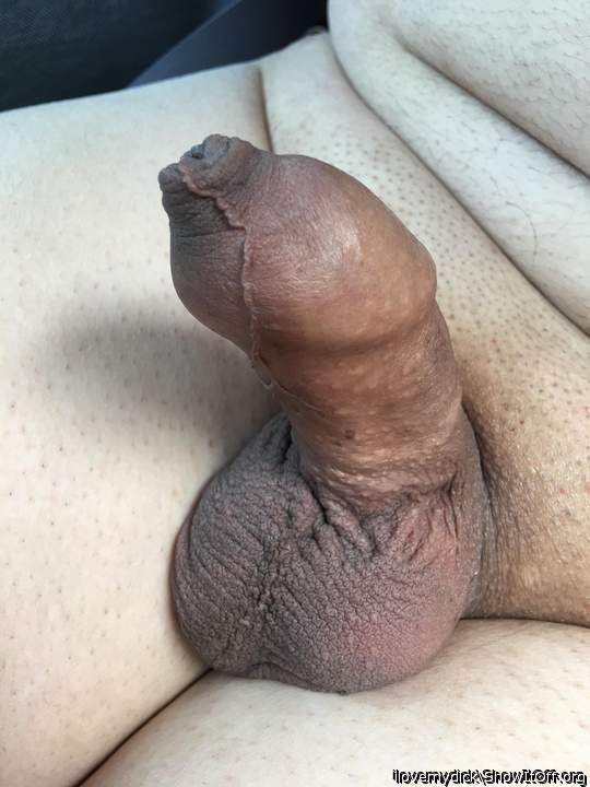 Your penis looks good with the foreskin pulled fully  forwar