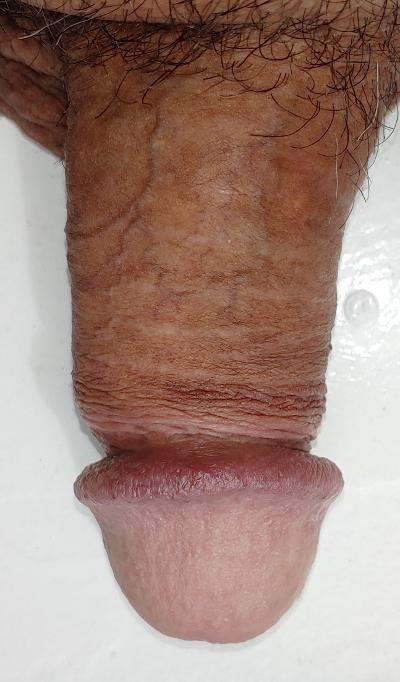 Adult image from M*C*S