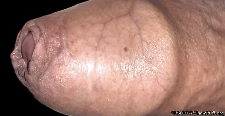 Perky Foreskin!