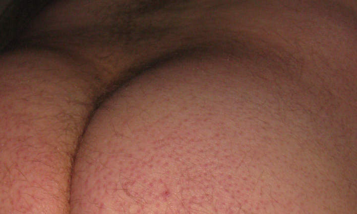 Adult image from iccockb4thee