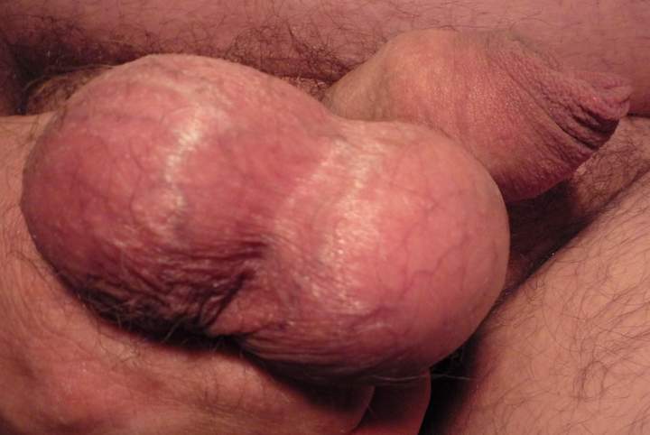 Adult image from markcl