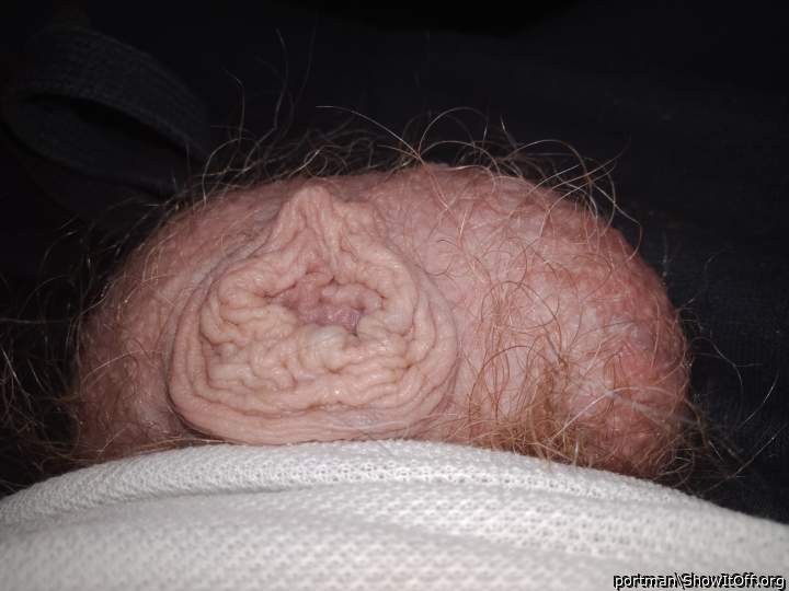 Hairy