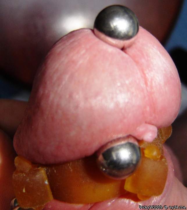 Glans closeup with tattered frenum 1