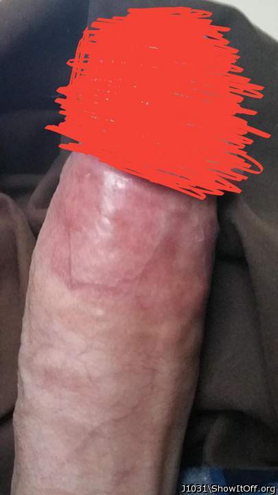 Adult image from J1031