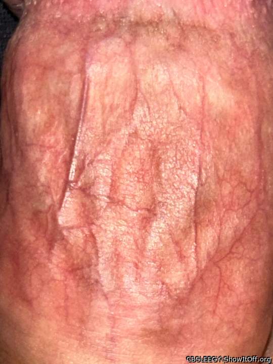 Can you see my 5 large veins inside?