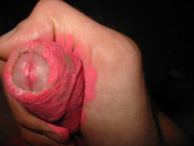 Adult image from freakyfrenchie