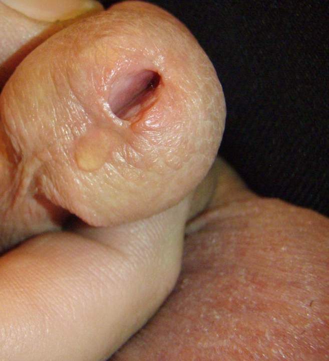 Adult image from lilsoftee