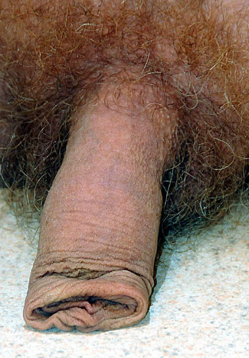 Adult image from slipper