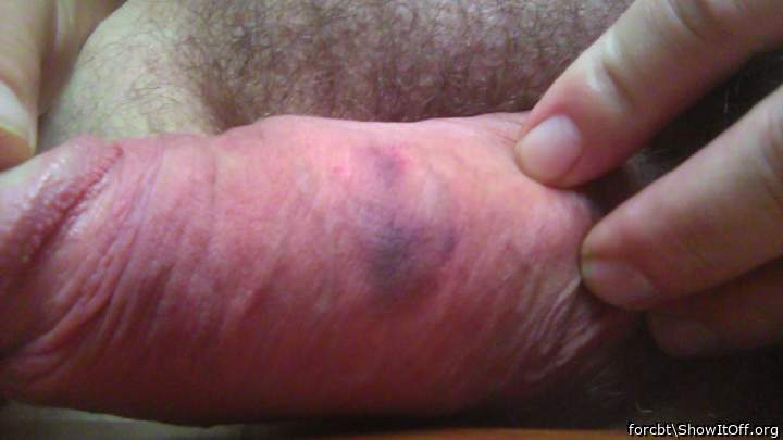Adult image from forcbt