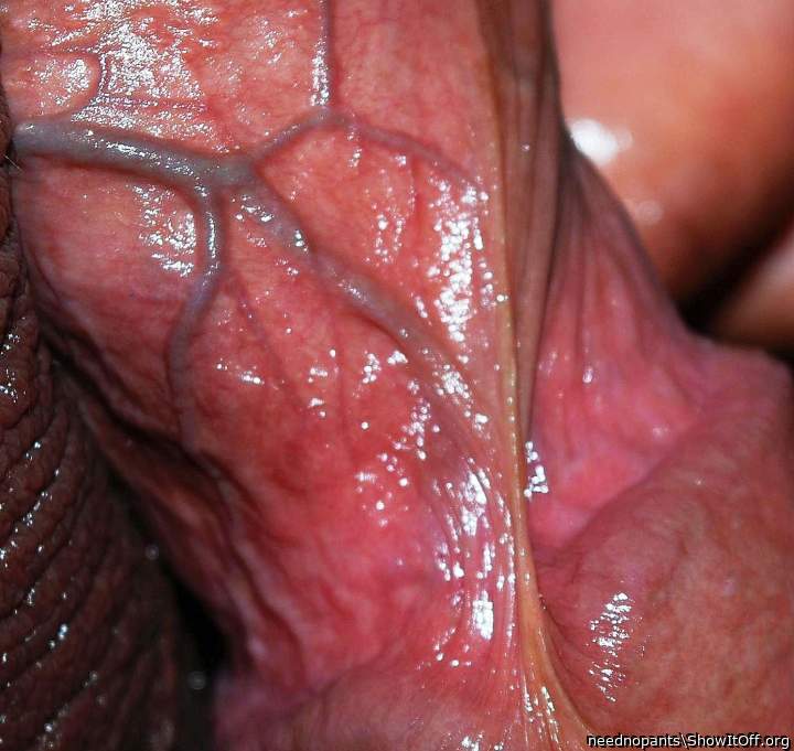 Beautiful veins !