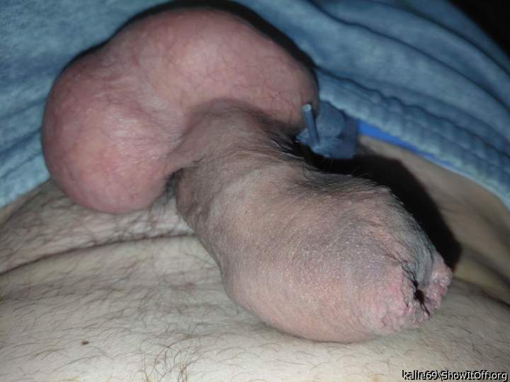 Vorhaut
