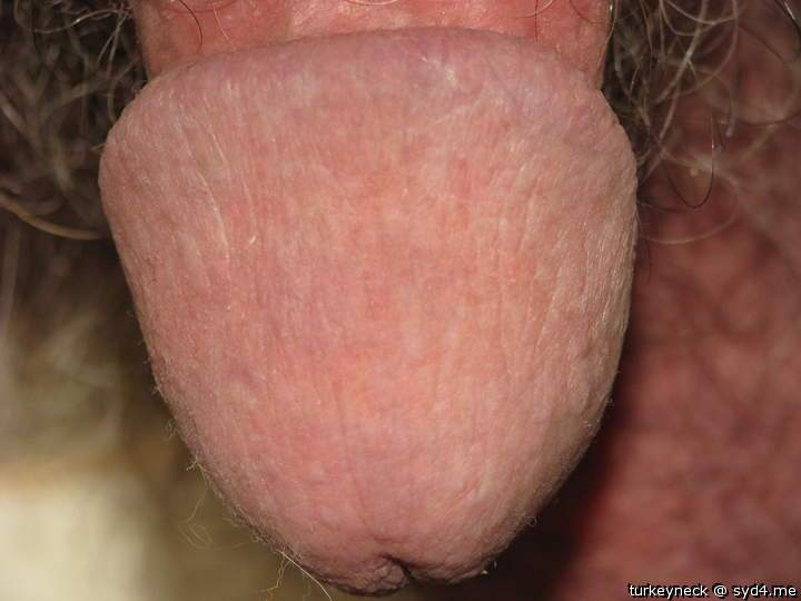Adult image from turkeyneck