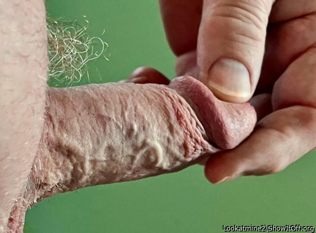 Penis