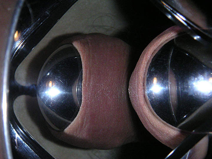 Adult image from slipper
