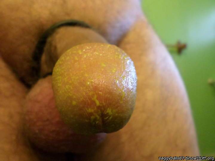 Yellow Penis Head - [3-27-15-4125]
