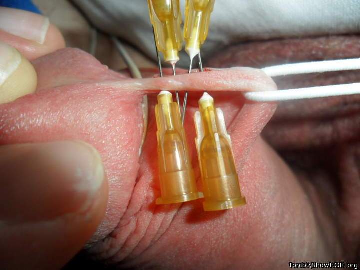 Adult image from forcbt