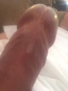 Adult image from Calgarycock