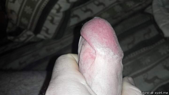 Adult image from skinb