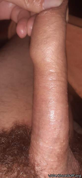 You have lots of foreskin to stretch