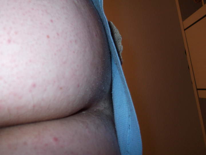 anal