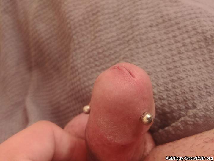 Still Healing, 1 week after