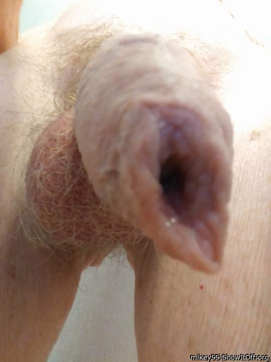 Foreskin