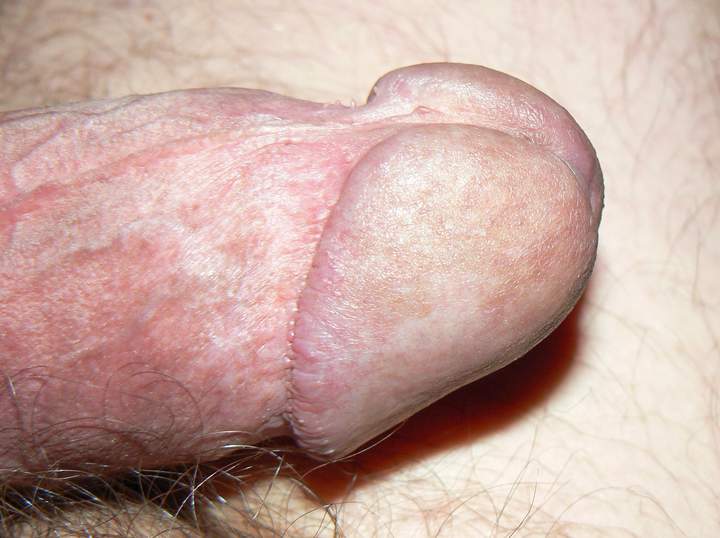 Adult image from eichel
