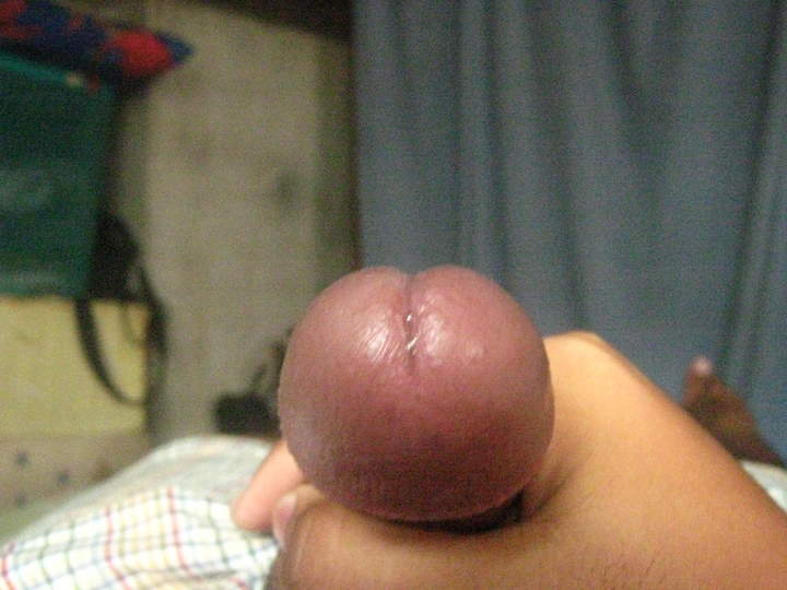 Adult image from bovine