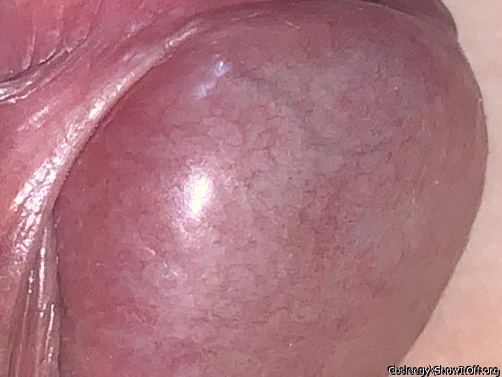 Wtf is that big blue vein, it�s so sensitive!