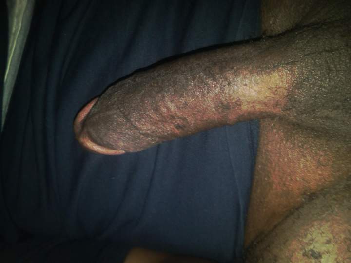Adult image from GaryMPLS72