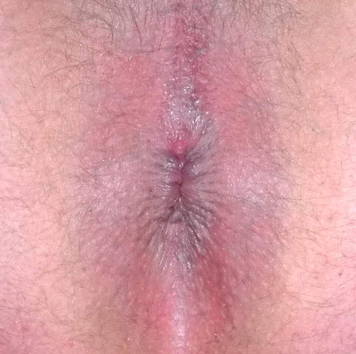 Adult image from Mitrandir