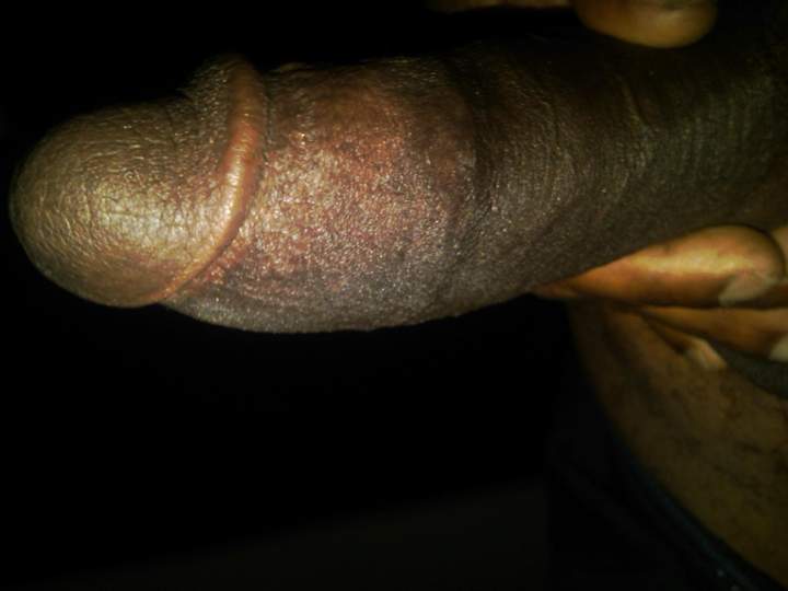 Adult image from GaryMPLS72