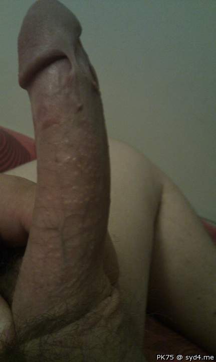 Love the skin bridge  