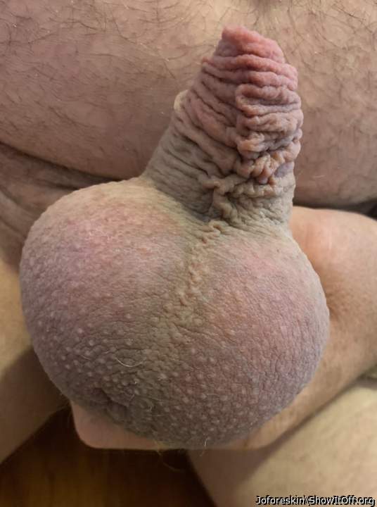 My foreskin