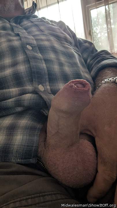 foreskin in place