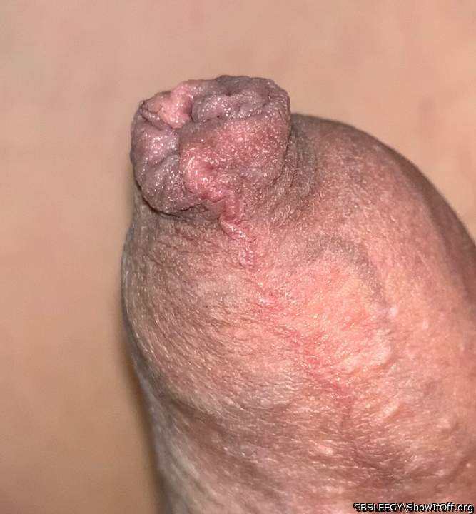 Not sure how this happened! Lol