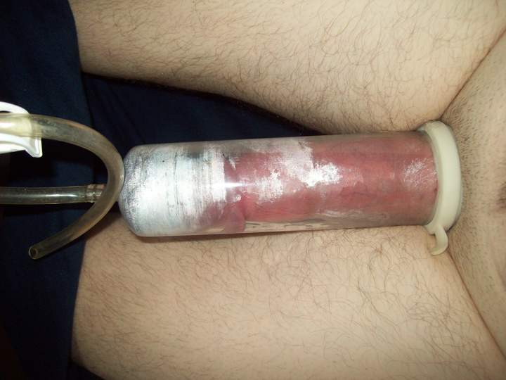 Adult image from Hornyashell
