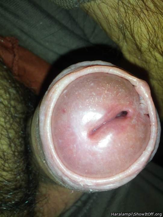 Hey Man... That is an awesome closeup!    