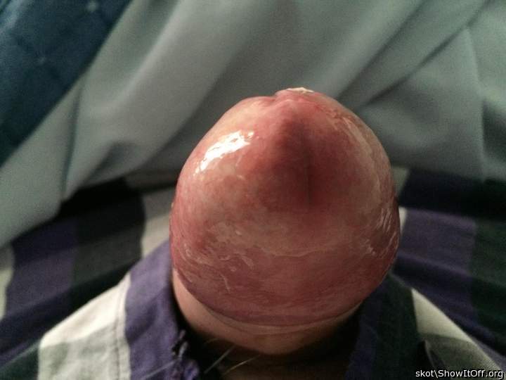 Shiny head