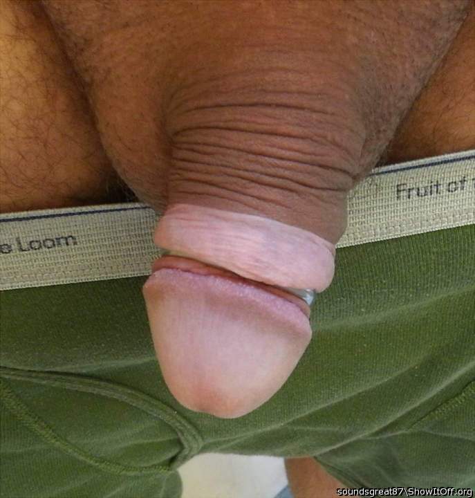 Steel glans ring holds my foreskin back