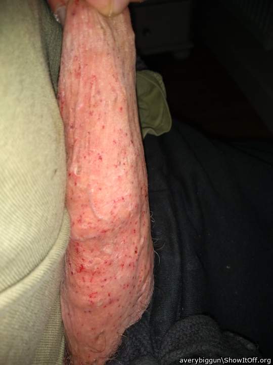 Scourged Again