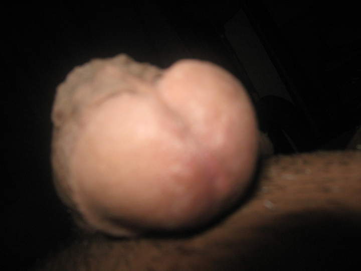 Adult image from bovine