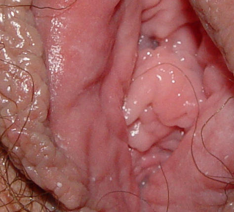 wifes uterus