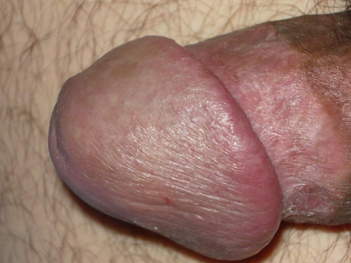 Adult image from iambisex
