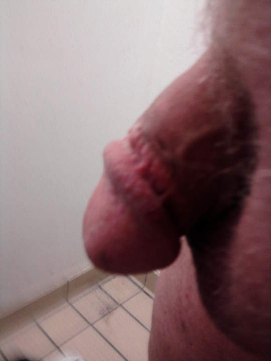 Adult image from fronve